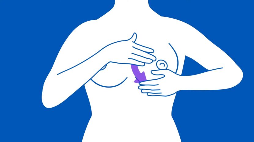 Breast Cancer Visual